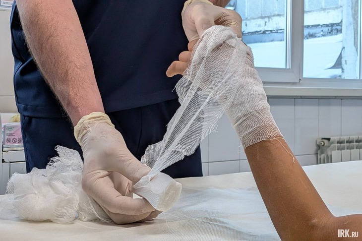 Случай стал четвертым в 2025-м, когда врачам отделения микрохирургии ИОКБ пришлось делать реплантацию пальца ребенку