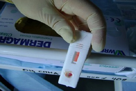 Тест на ВИЧ. Изображение с сайта Центра СПИД
