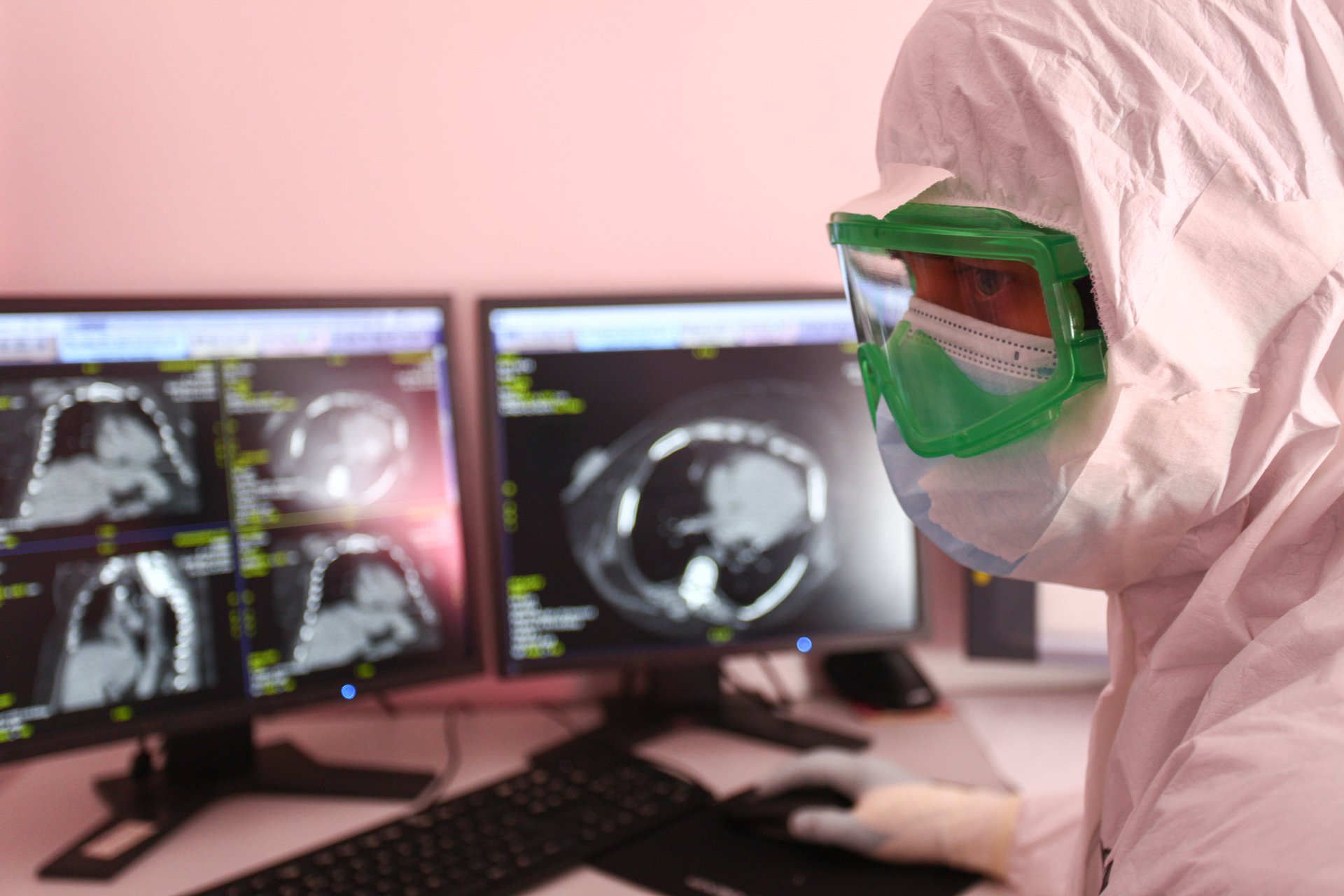 Врач-рентгенолог Алексей Млявый в полутемном кабинете описывает снимки легких
