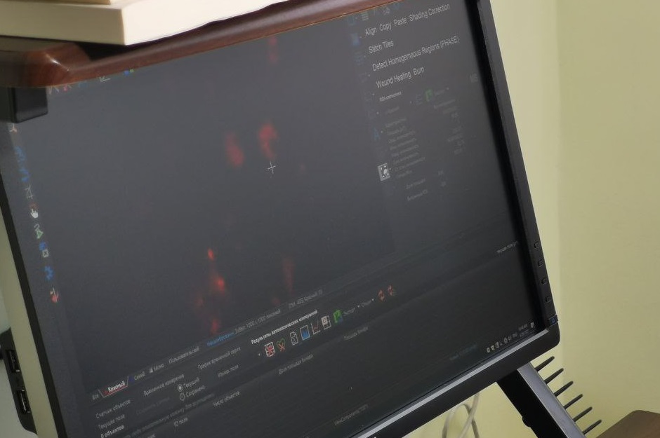 При воздействии токсичным веществом лизосомы разрушаются, и вся клетка окрашивается красным