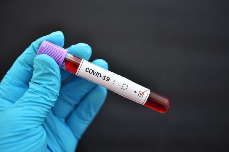 Тест на коронавирус. Фото с сайта azned.net
