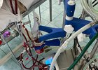 Проведение ЭКМО. Фото минздрава Иркутской области