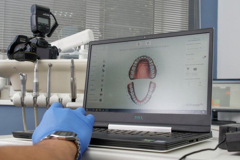 Внутриротовой сканер — это современное устройство для сканирования внутриротовой полости, которое применяется для создания цифровых слепков в стоматологии