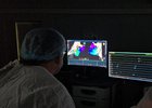 Операция. Фото пресс-службы минздрава Иркутской области