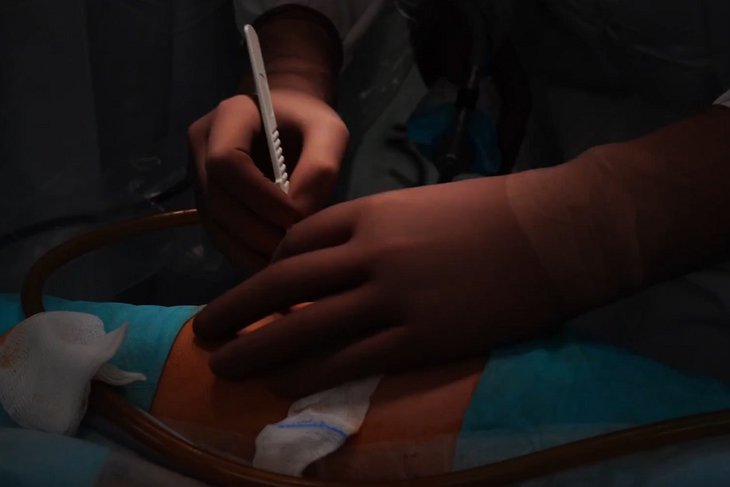 Операция. Скриншот видео Юрия Козлова «ВКонтакте»