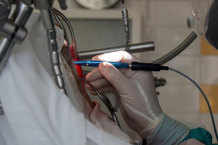 Операция. Фото пресс-службы Иркутской областной детской клинической больницы