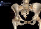 Травмы юного мотоциклиста. Изображение Ивано-Матренинской детской больницы