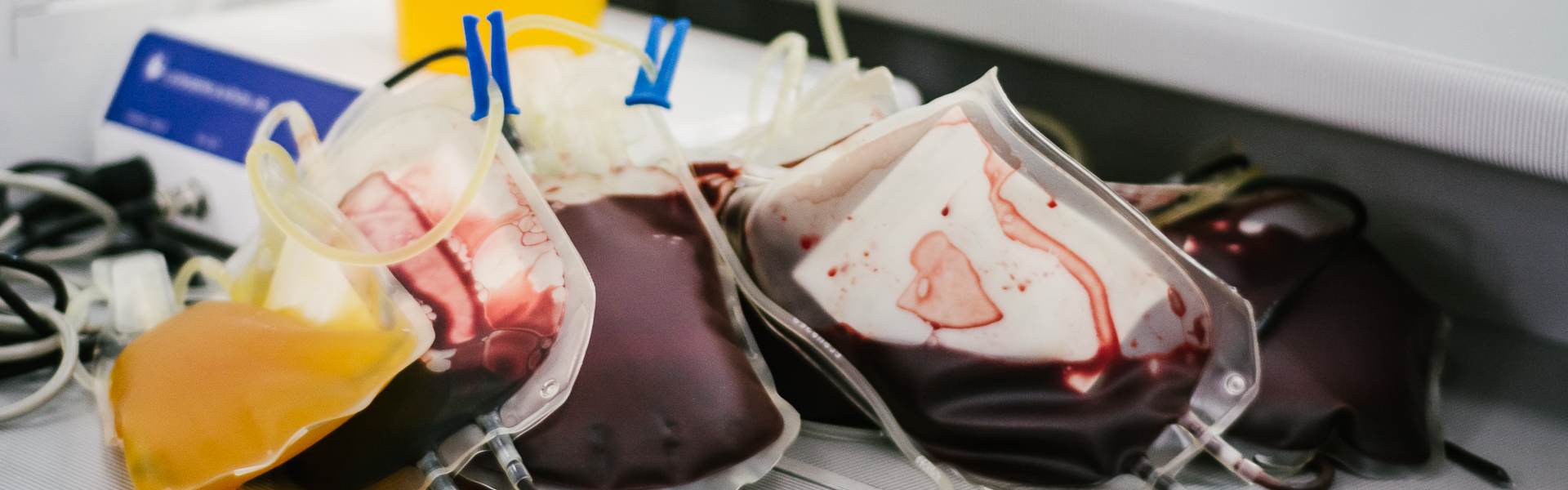 Как перерабатывают и хранят донорскую кровь